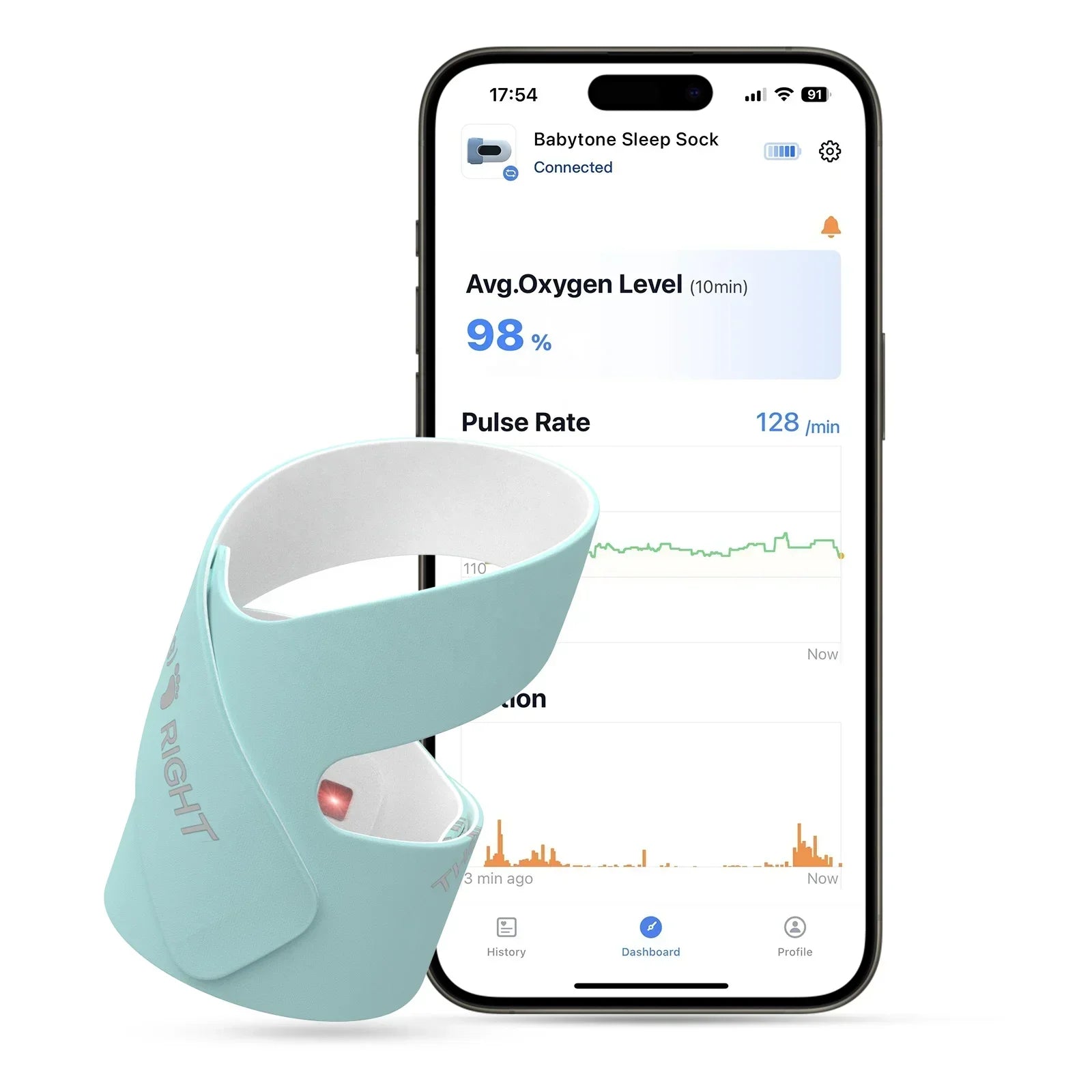 BabyO2 Smart Sleep Sock