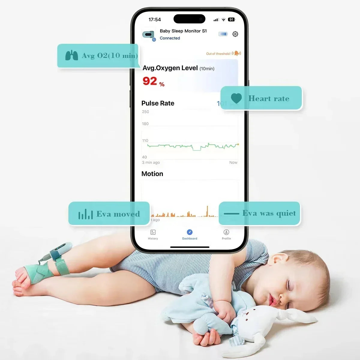 BabyO2 Smart Sleep Sock